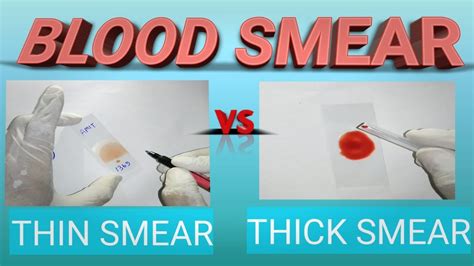 thin and thick smear procedure